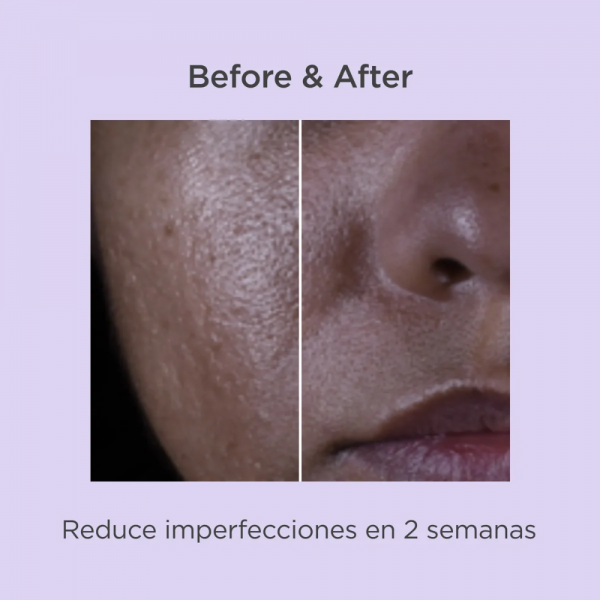 Isdinceutics Salicylic Renewal, 30 ml. - Isdin