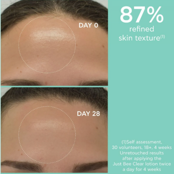 Just Bee Clear, Loción Purificante Minimizador, 200 ml. - Apivita