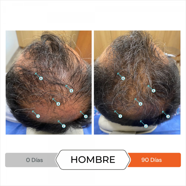 Revita® Acondicionador Estimulante, 205 ml. - DS Laboratories