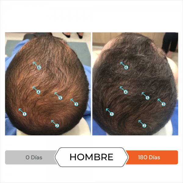 Revita® Anticaída, 30 Comp. - DS Laboratories