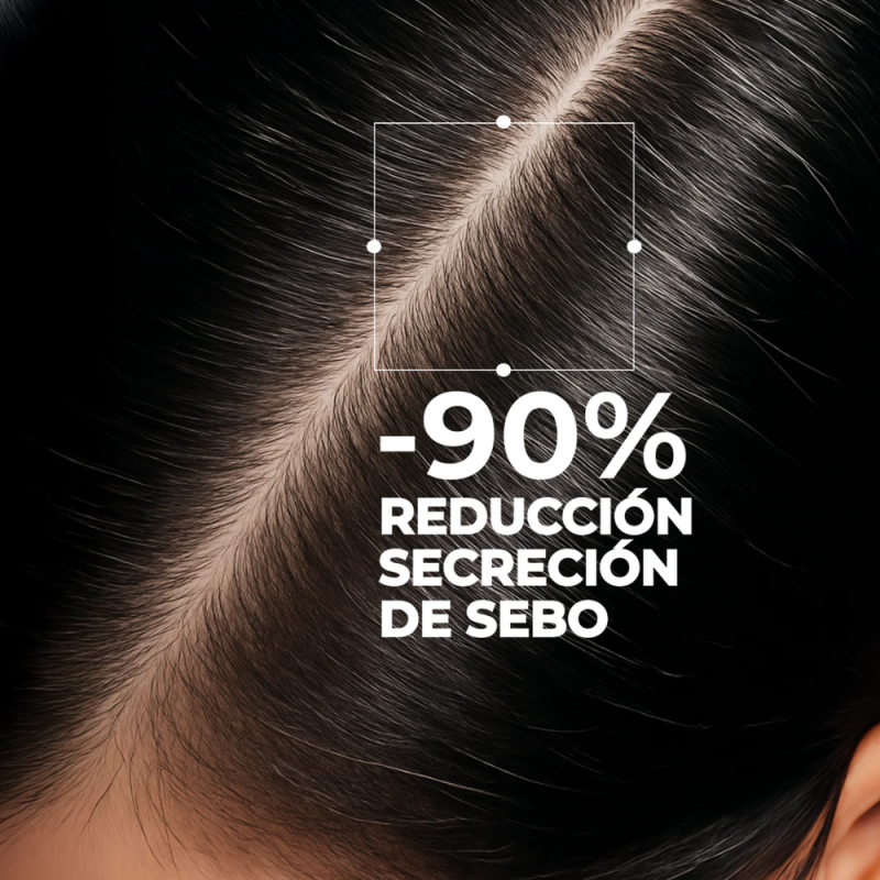 Sérum Capilar Scalp Exfoliating, 50 ml. - Segle Clinical