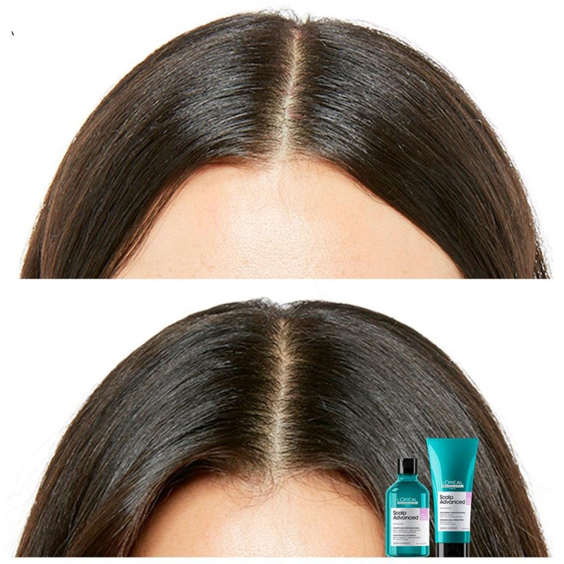 L'oréal Scalp Advanced Dermo - Regulator Professional Shampoo 500ml - L'oral Professionnel