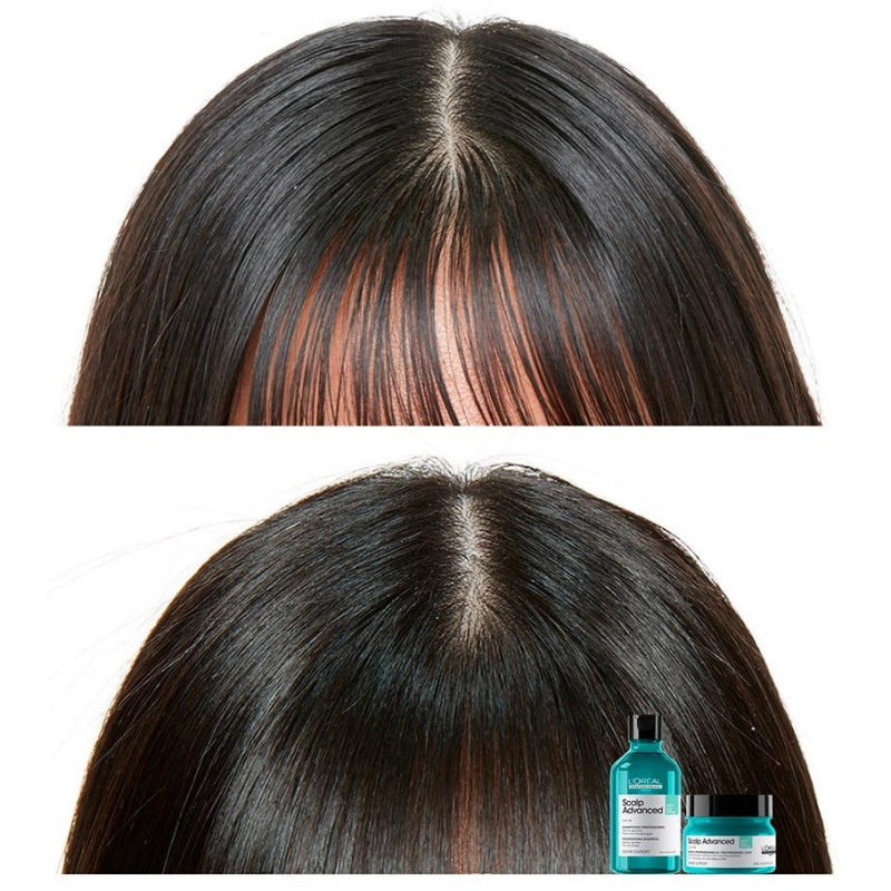 L'oréal Scalp Advanced Anti - Oiliness Dermo - Purifier Shampoo 300ml - L'oral