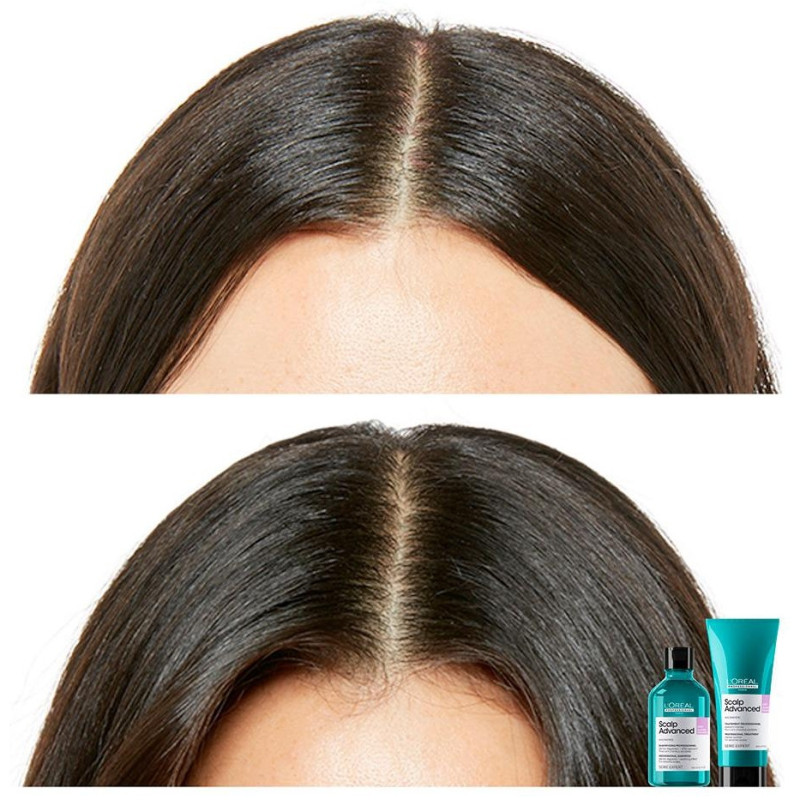 Scalp Advanced Champú Recarga 500 ml - Loral Professionnel Paris