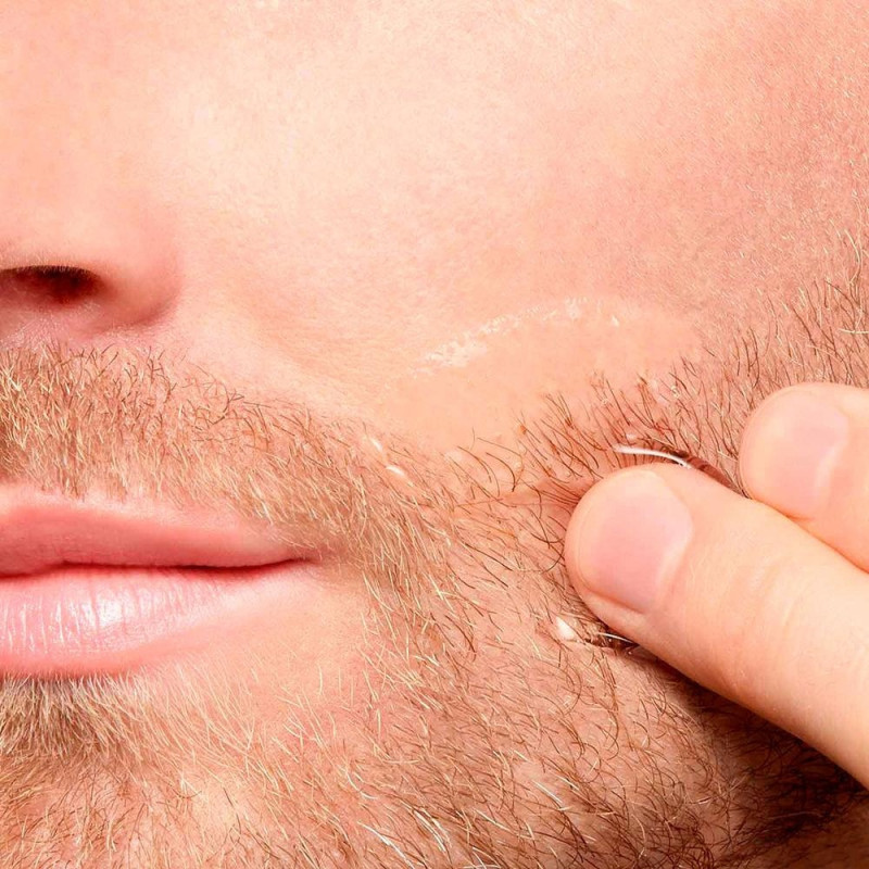 Men Loción After Shave 100 Ml