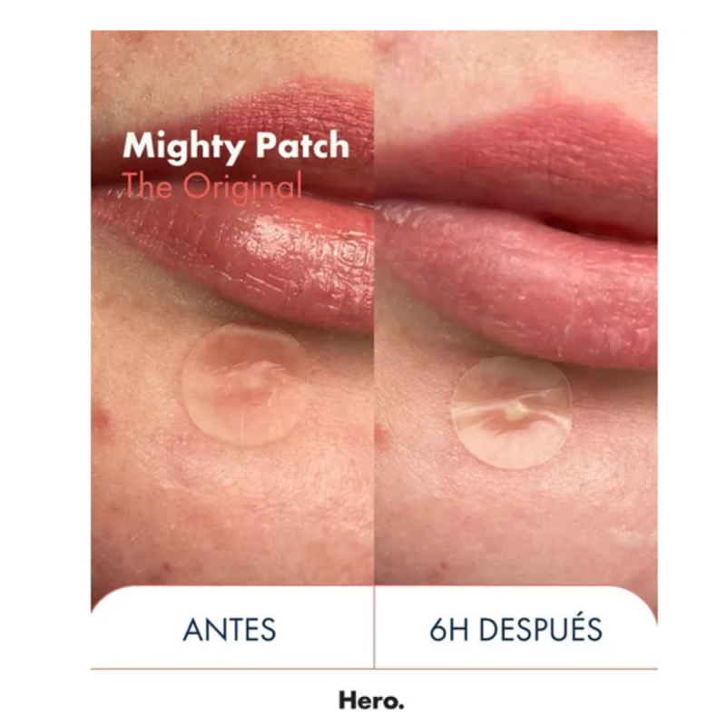 Hero Mighty Patch The Original, 24 un. - Orkla