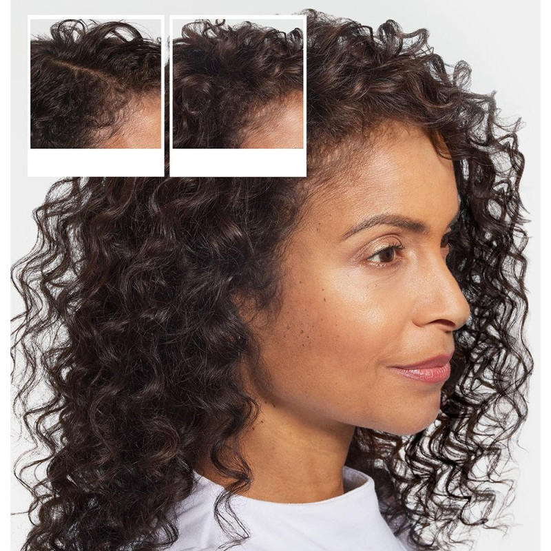Champú Anticaída - Champú para la Caída del Cabello 240 ml - Nioxin
