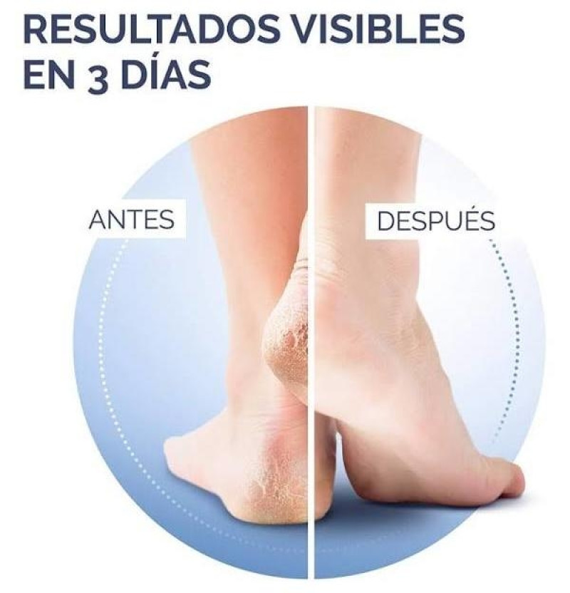 Crema Talones Agrietados K+ (1 Envase 60 ml) - Reckitt Benckiser