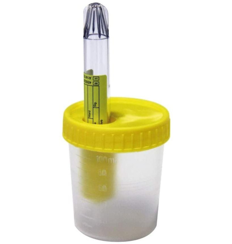 Alvita Envase Recogida Orina, Tubo de Vacio, Kit Esteril - Alliance Healthcare