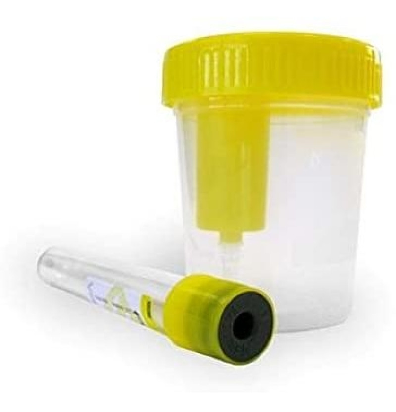 Alvita Envase Recogida Orina, Tubo de Vacio, Kit Esteril - Alliance Healthcare