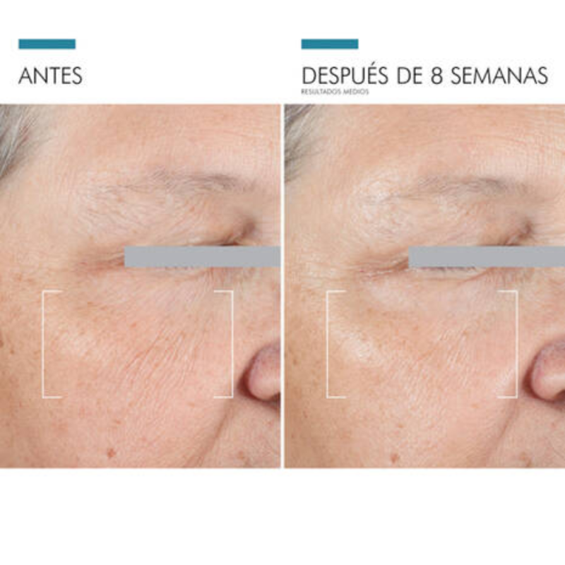 A.G.E. Advanced Eye, 15 ml. - Skinceuticals