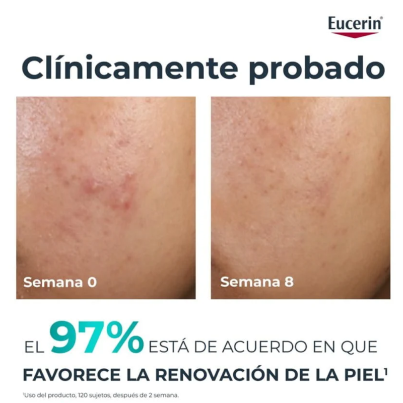 DermoPure Clinical Peeling 10, 40 ml. - Eucerin