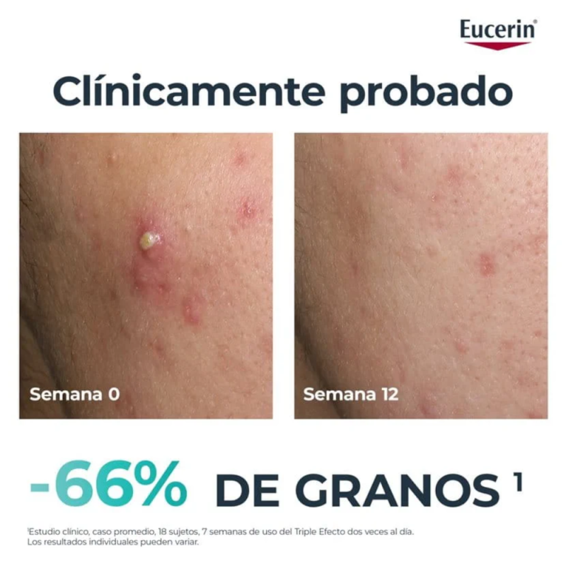 DermoPure Clinical Triple Action, 40 ml. - Eucerin 