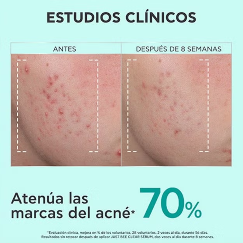 Just Bee Clear Sérum Anti-Imperfecciones y Marcas, 30 ml.- Apivita