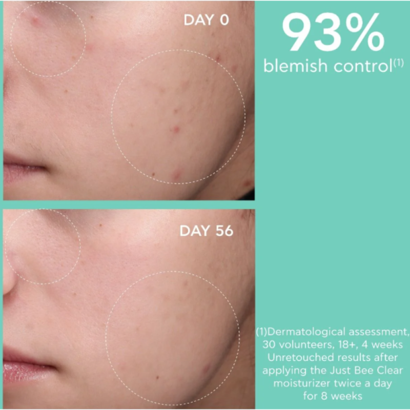 Just Bee Clear, Crema Anti-Imperfecciones Matificante Hidratante, 40 ml. - Apivita