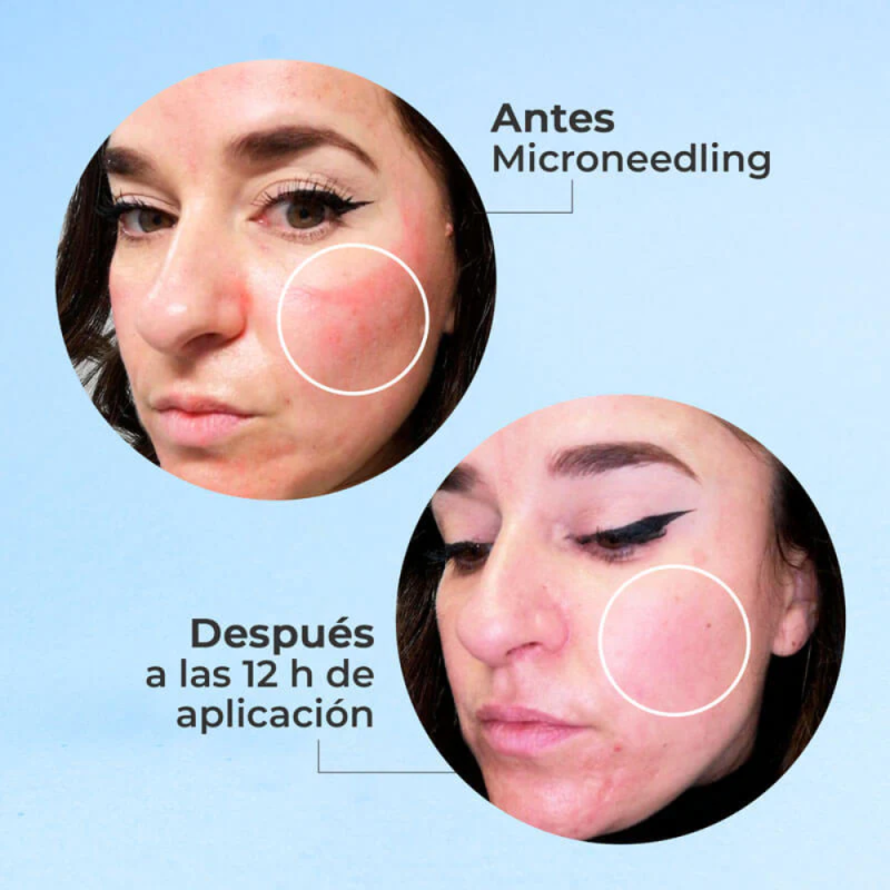Cofre Antiaging Piel Sensible : Skin Factor Sérum, 30ml + Skin Factor Crema, 50ml. - Segle Clinical