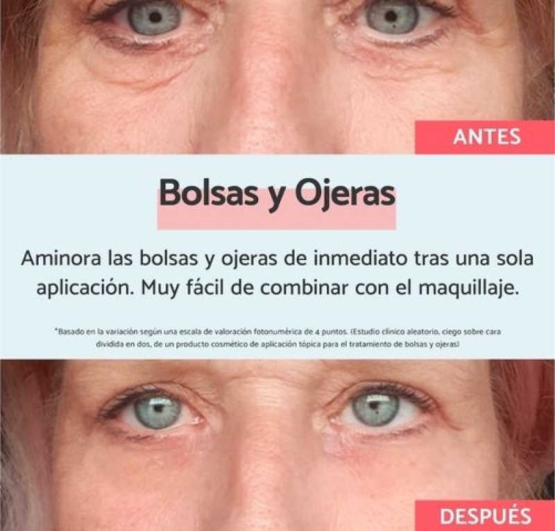 Remescar Bolsas y Ojeras, 8 ml. - Karo Healthcare