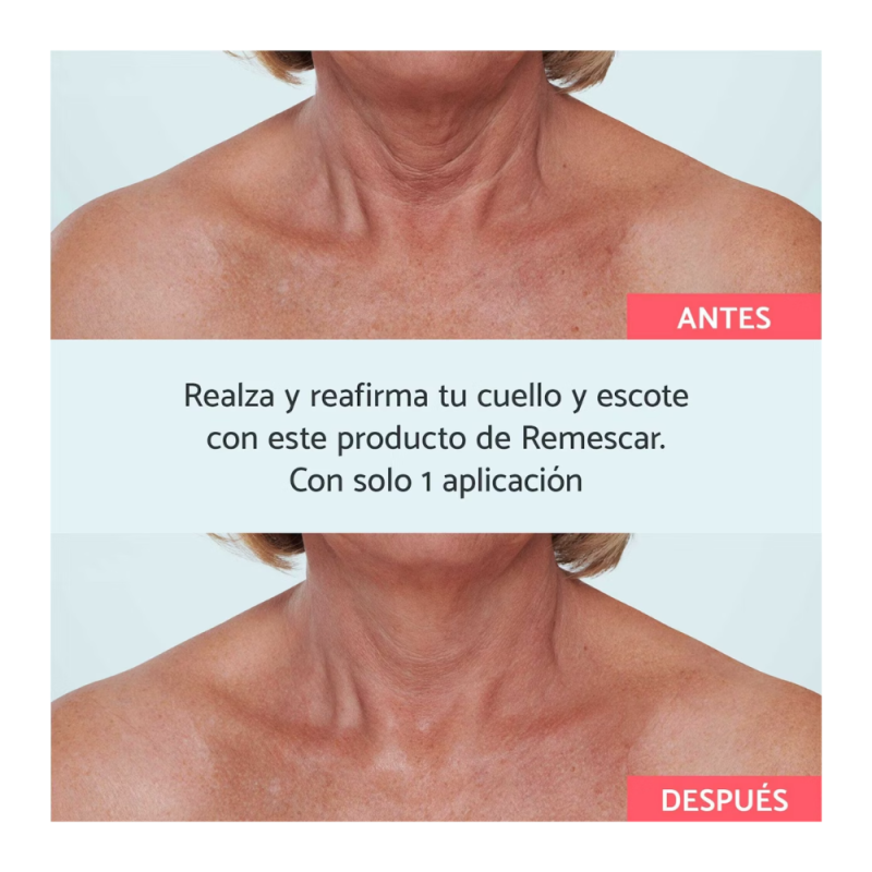 Remescar Crema Cuello y Escote, 40 ml. - Remescar