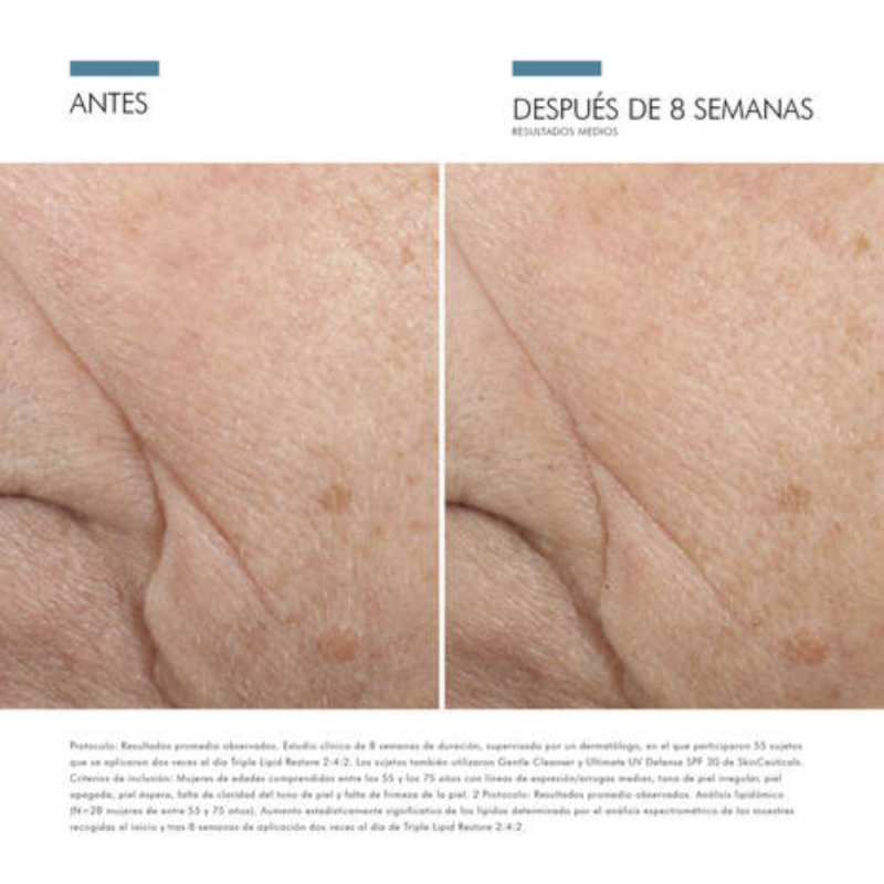 Triple Lipid Restore 2:4:2, 48 ml. - Skinceuticals