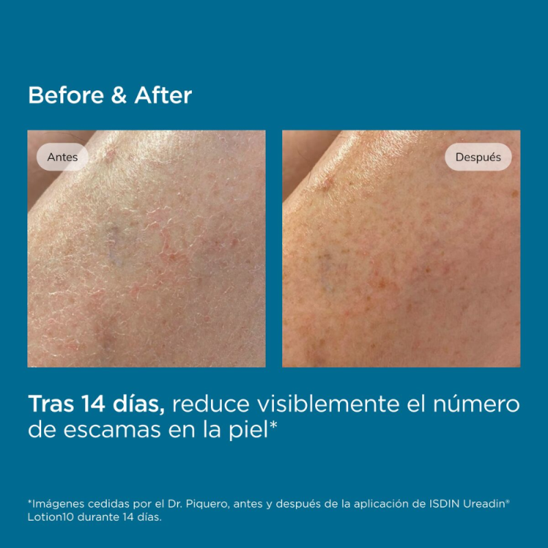 Ureadin Lotion10 Hidratación Intensa, 400 ml. - Isdin